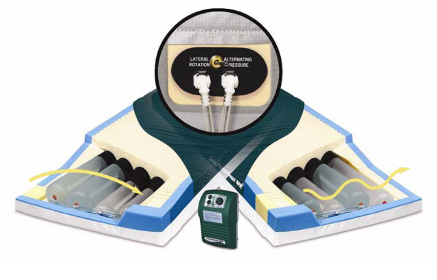 Alternating Pressure Mattress